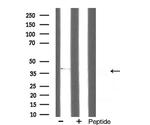 GPR91 Antibody in Western Blot (WB)