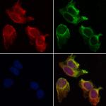 beta Synuclein Polyclonal Antibody