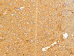 KChIP3 Antibody in Immunohistochemistry (Paraffin) (IHC (P))