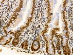PIASy Polyclonal Antibody