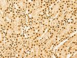 PIASy Antibody in Immunohistochemistry (Paraffin) (IHC (P))