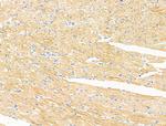 ACTA1 Antibody in Immunohistochemistry (Paraffin) (IHC (P))