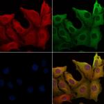 Gastrin Polyclonal Antibody