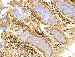 Gastrin Antibody in Immunohistochemistry (Paraffin) (IHC (P))