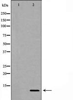 Gastrin Antibody in Western Blot (WB)