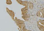 Cytokeratin 15 Antibody in Immunohistochemistry (Paraffin) (IHC (P))