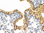 CDKN2C Antibody in Immunohistochemistry (Paraffin) (IHC (P))