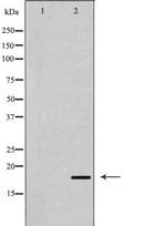 CDKN2C Antibody in Western Blot (WB)