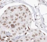 Cyclin F Polyclonal Antibody