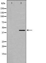 Dematin Polyclonal Antibody