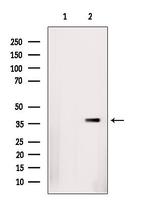 hnRNP D Polyclonal Antibody