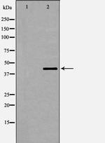 Phospho-Dematin (Ser403) Polyclonal Antibody