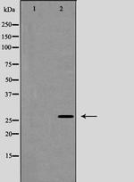 Phospho-Caveolin 2 (Tyr27) Polyclonal Antibody