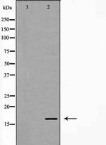 Phospho-Stathmin 1 (Ser25) Antibody in Western Blot (WB)