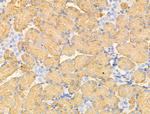 GLUT3 Antibody in Immunohistochemistry (Paraffin) (IHC (P))