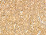 RhoH Antibody in Immunohistochemistry (Paraffin) (IHC (P))