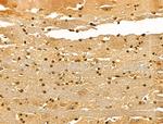 Ku70/Ku80 Antibody in Immunohistochemistry (Paraffin) (IHC (P))