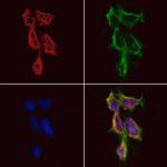 HDAC10 Polyclonal Antibody