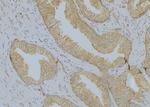 Cytokeratin 16 Antibody in Immunohistochemistry (Paraffin) (IHC (P))