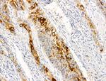 Cytokeratin 16 Antibody in Immunohistochemistry (Paraffin) (IHC (P))