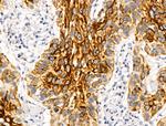 Cytokeratin 16 Antibody in Immunohistochemistry (Paraffin) (IHC (P))