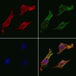 Cytokeratin 16 Polyclonal Antibody