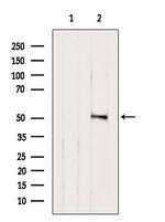 Cytokeratin 16 Antibody in Western Blot (WB)