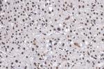 CDKN2B Antibody in Immunohistochemistry (Paraffin) (IHC (P))