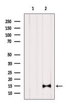 CDKN2B Antibody in Western Blot (WB)