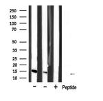 CDKN2B Antibody in Western Blot (WB)