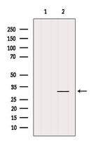 TNFAIP6 Antibody in Western Blot (WB)