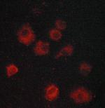 IkB epsilon Polyclonal Antibody