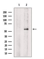 DOK2 Polyclonal Antibody