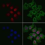 RB1 Polyclonal Antibody