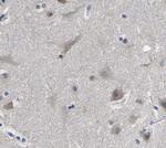 hnRNP C1/C2 Polyclonal Antibody