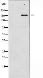 Bcr Polyclonal Antibody