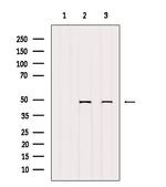 VDR Antibody in Western Blot (WB)