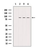 GYS1 Polyclonal Antibody