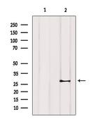 Cardiac Troponin I Polyclonal Antibody