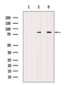 alpha Adducin Antibody in Western Blot (WB)