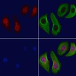 BRCA1 Antibody in Immunocytochemistry (ICC/IF)
