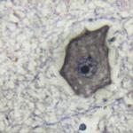 GP130 Polyclonal Antibody