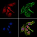 LIMK1/LIMK2 Polyclonal Antibody