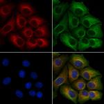 RHOA Polyclonal Antibody