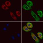 NFATC3 Polyclonal Antibody