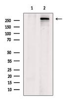 Acetyl-CoA Carboxylase Antibody in Western Blot (WB)