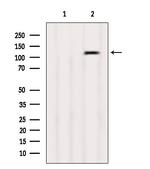 PKD1/2/3/PKC mu Polyclonal Antibody