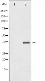 IkB beta Polyclonal Antibody