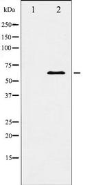 DOK1 Antibody in Western Blot (WB)