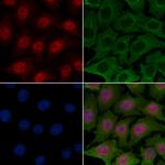 RPS6KB2 Polyclonal Antibody